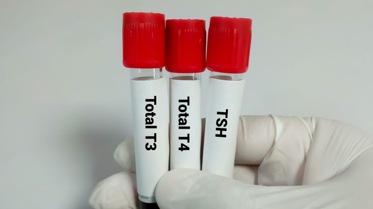 Total T4 Testi