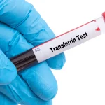 Transferrin Testi