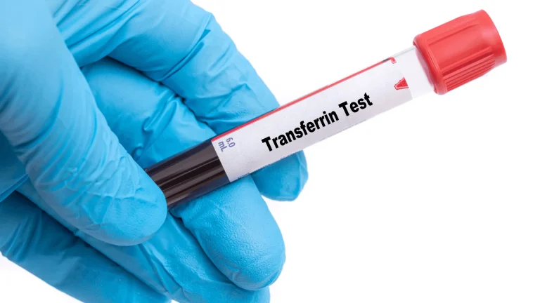 Transferrin Testi